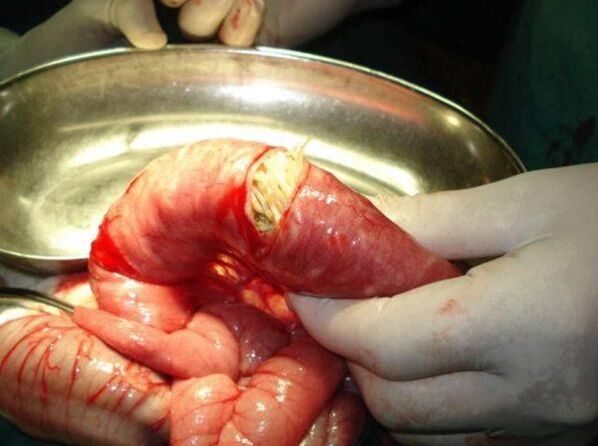 More than dangerous worms