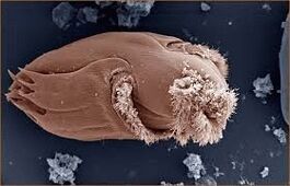 Microorganisms cause disease in humans