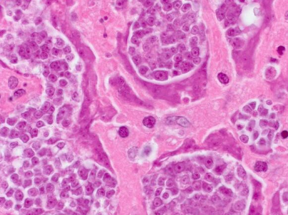 Parasitic research in one person