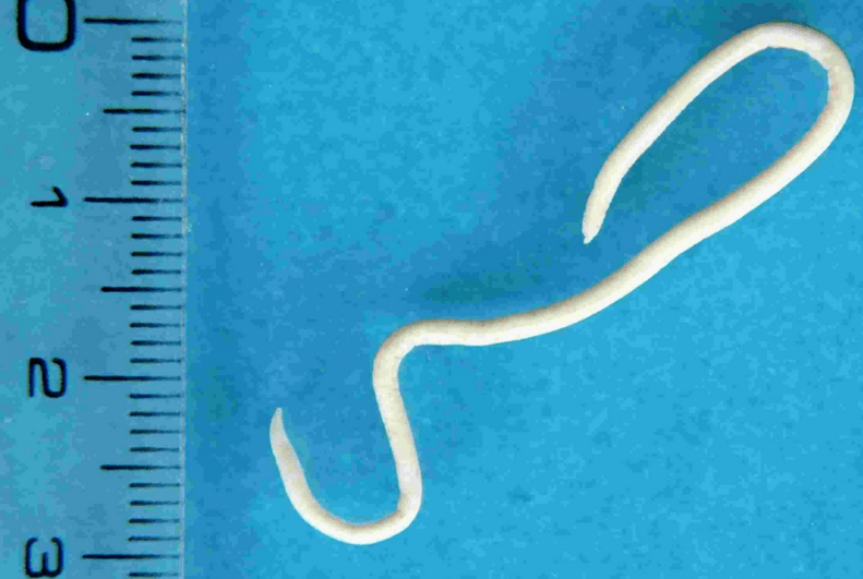 Description of human parasites