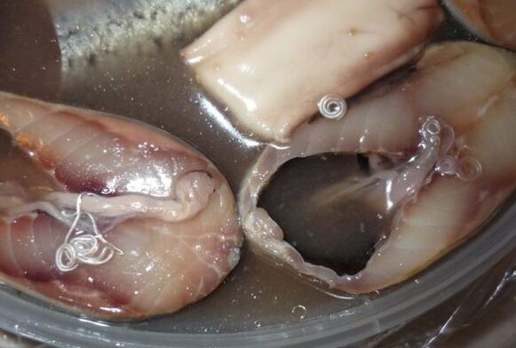 Pathways of human infection by parasites