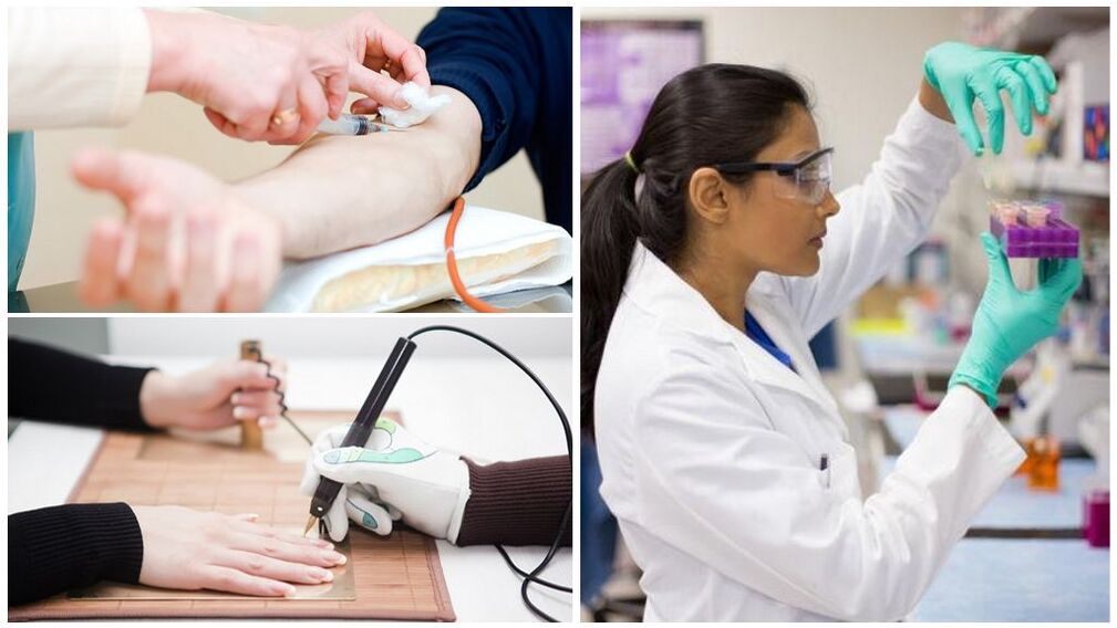 Diagnostic method to detect parasites in the body