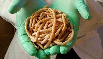 The method of eliminating parasites from the body