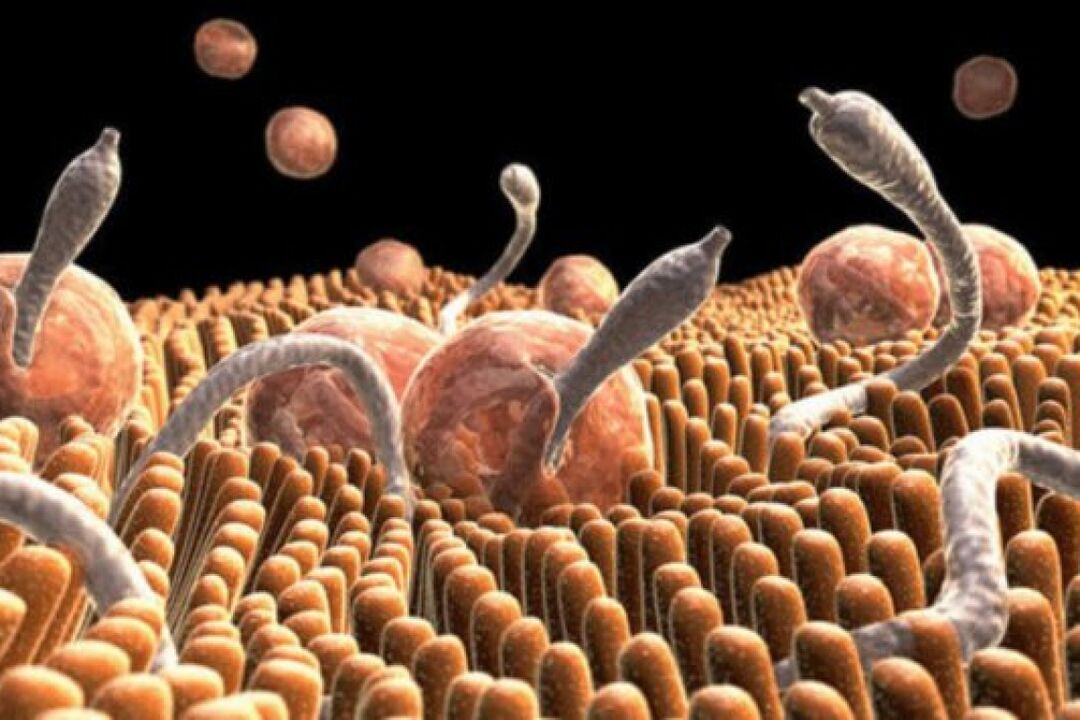 types of parasites in humans