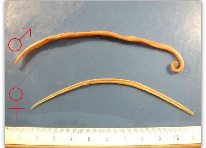 Size of roundworm - type of worm that infects the respiratory tract of adults